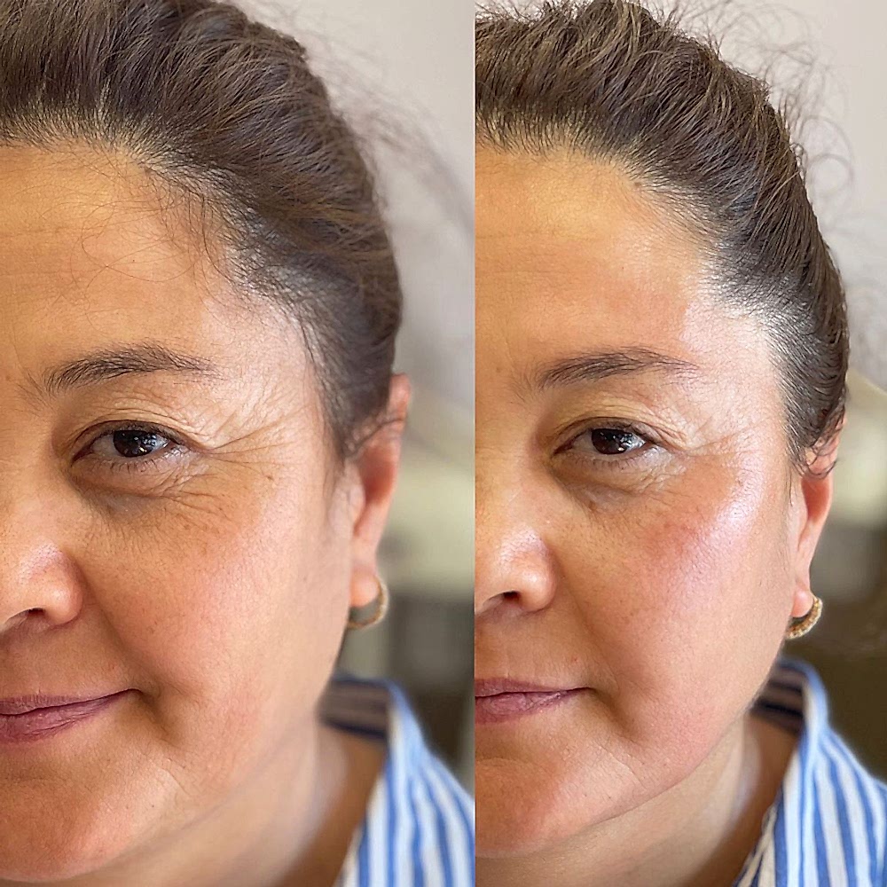 Bukkal & Yüz Masajı